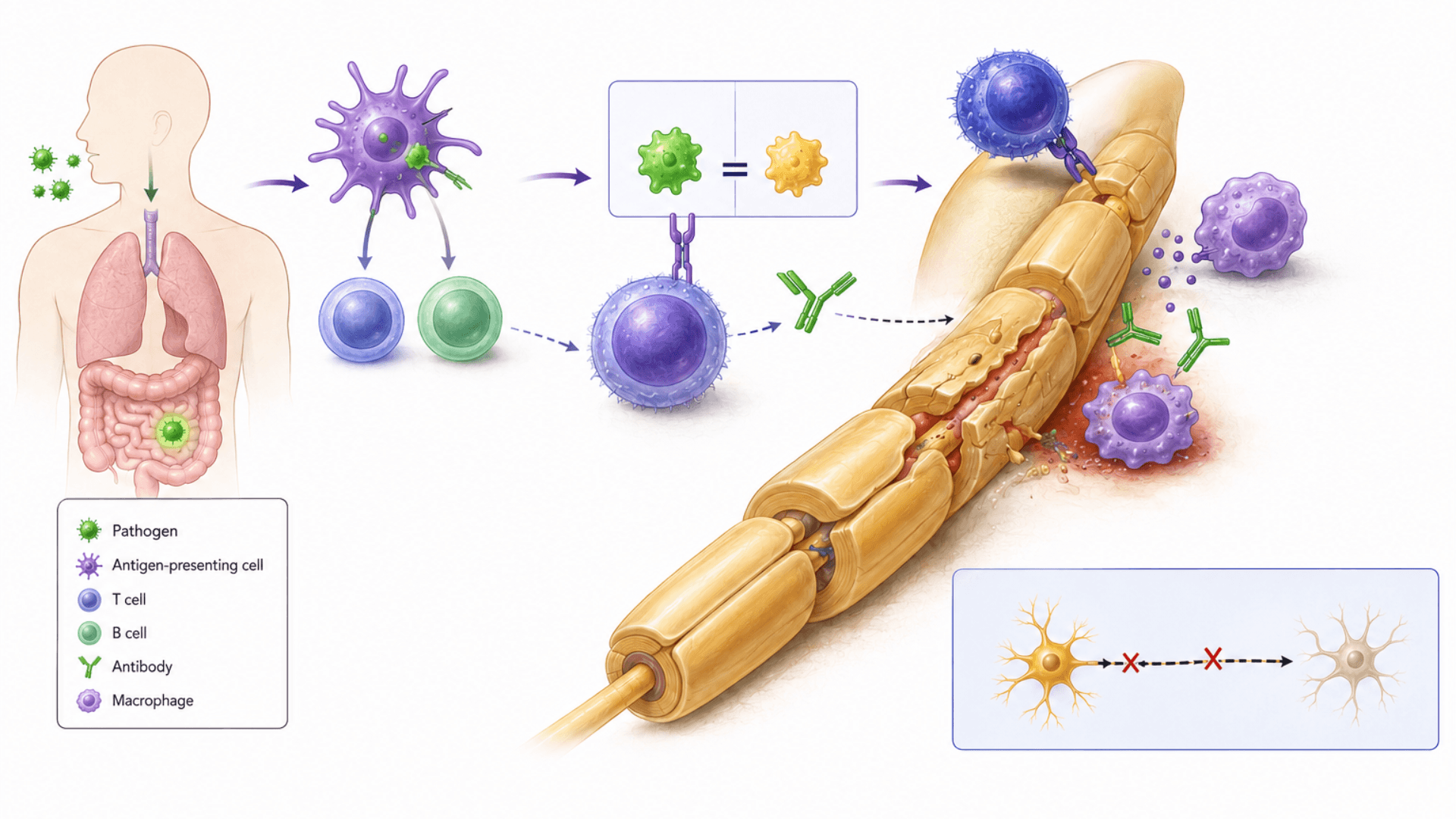 Immune response and nerve damage diagram